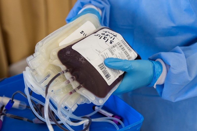 tratamiento de plasma