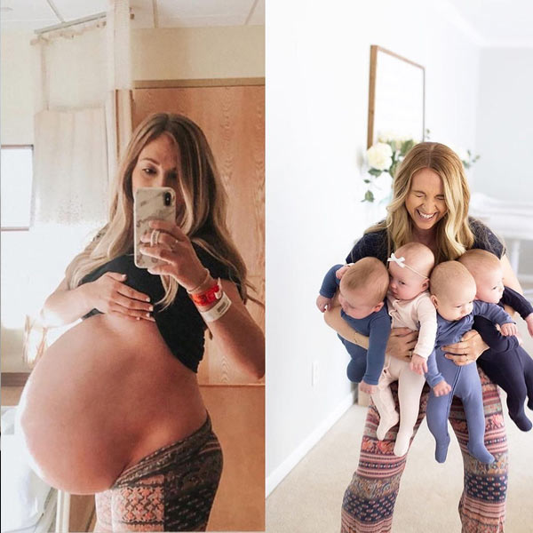 fotos de antes y después del embarazo