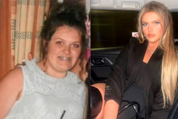 revelación después de perder 32 kg