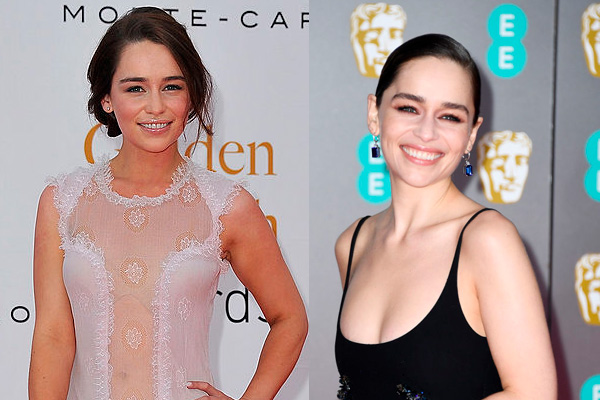 s rostros de las celebridades han cambiado