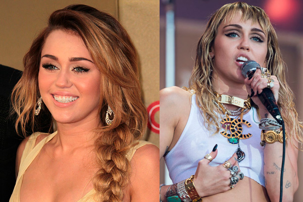 s rostros de las celebridades han cambiado