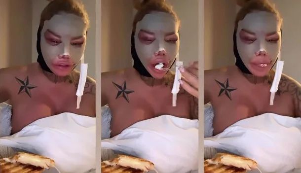 gasta millones en cirugía plástica