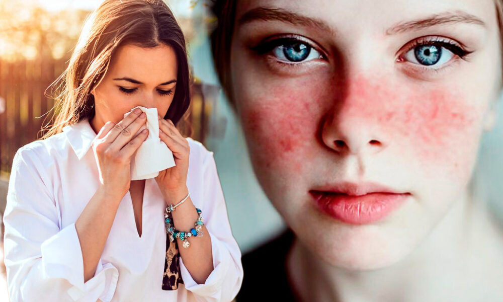 la alergia causa granos en la car