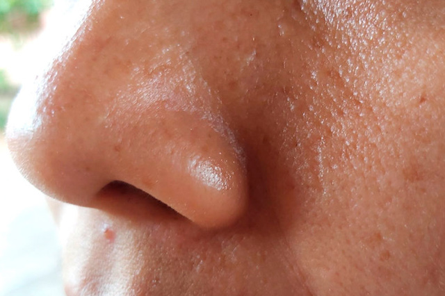 reconocer el tipo de piel 