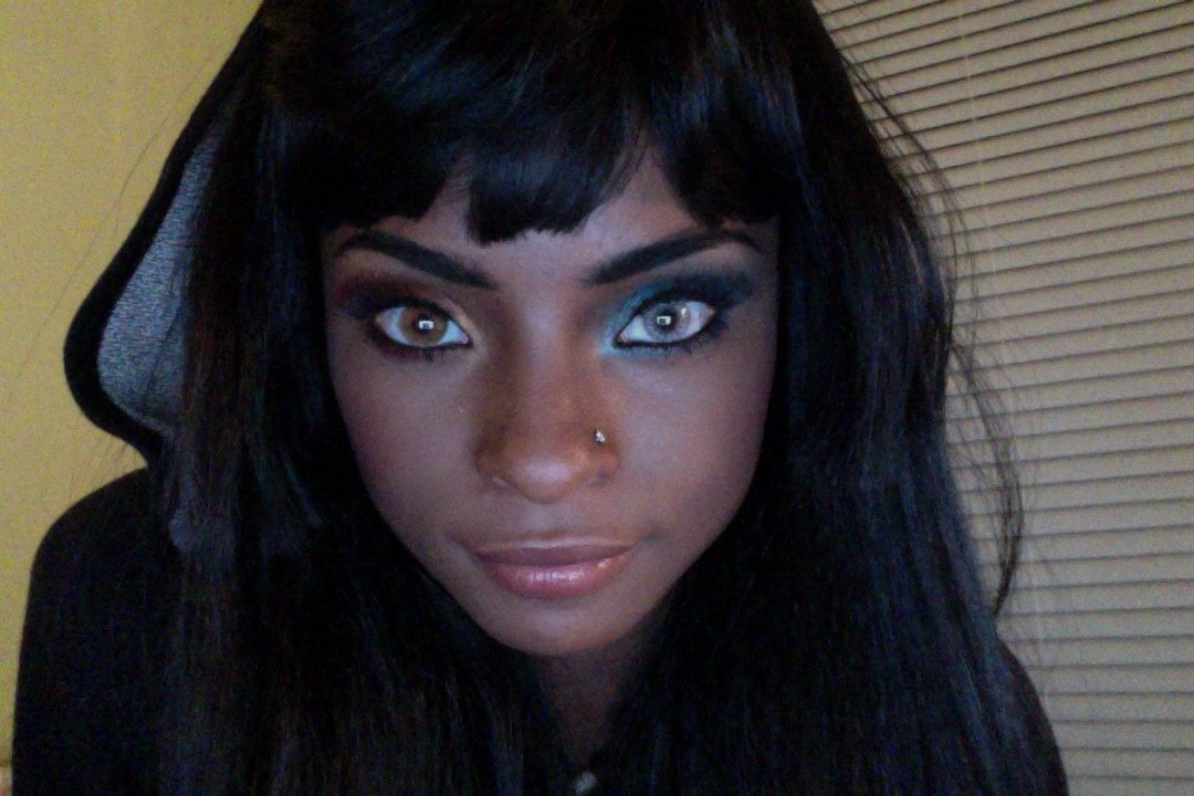 Hermosas mutaciones 15 heterocromia11 fotos impresionantes