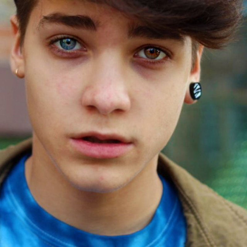 Hermosas mutaciones 15 heterocromia14 fotos impresionantes