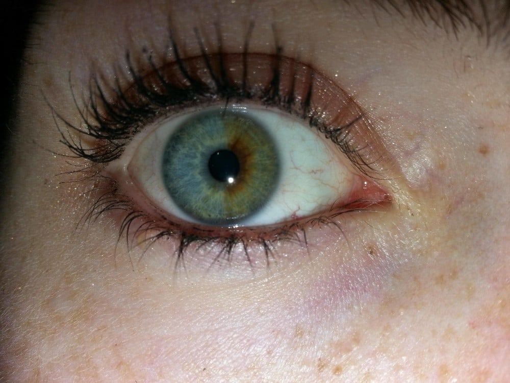 Hermosas mutaciones 15 heterocromia2 fotos impresionantes