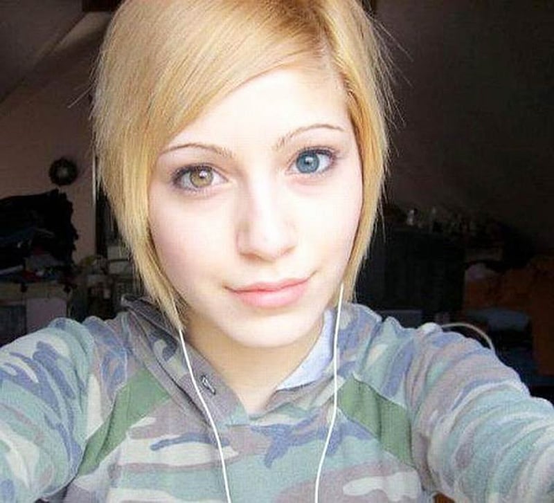 Hermosas mutaciones 15 heterocromia3 fotos impresionantes