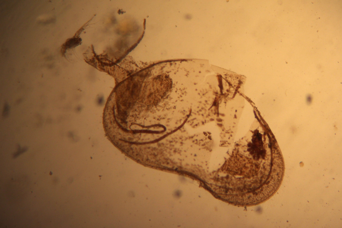 6. Microscopecam, Nueva York, Estados Unidos.