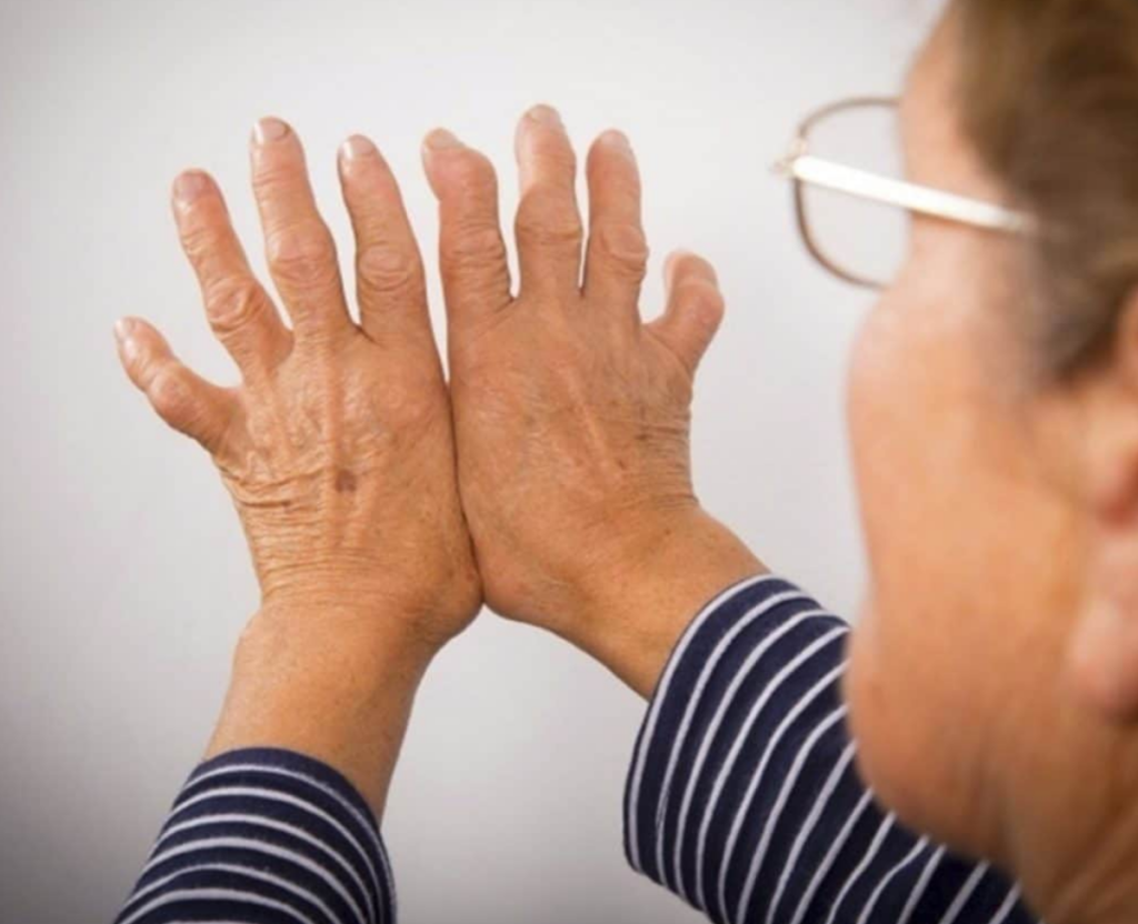 Factores psicológicos