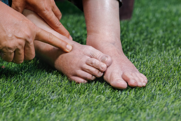 Pies de mujer anciana hinchados