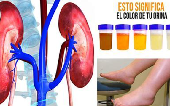 Señales de problemas renales