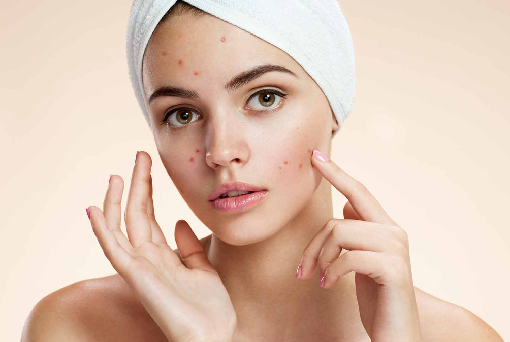 Puntos rojos en la cara